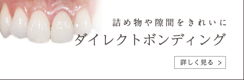 ダイレクトボンディング