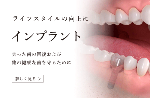 インプラント